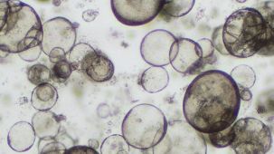 Forskolin-Induced Swelling of Airway Organoids Derived from Healthy and Cystic Fibrosis Donors