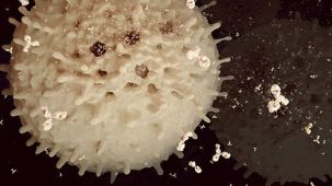 How to Isolate Antigen-Specific T Cells