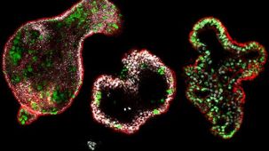How to Differentiate hiPSCs into Colonic Organoids Using STEMdiff™ Intestinal Organoid Kit
