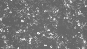How to Prepare Conditioned Medium for the Expansion of Epithelial Cells