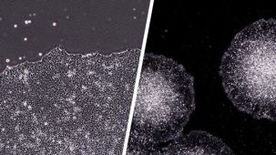 How to Coat Cultureware with STEMmatrix™ BME for Human Pluripotent Stem Cell Culture