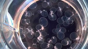How to Extract CSF-Like Fluid from Choroid Plexus Organoids
