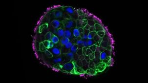 How to Generate Apical-Out Nasal Organoids