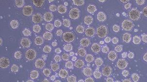 How to Differentiate hPSCs to Lymphoid-Competent CD34+ Hematopoietic Stem and/or Progenitor Cells Using a Scalable Suspension Protocol