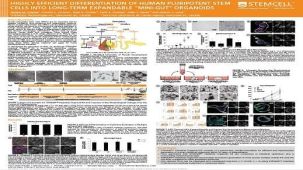 Highly Efficient Differentiation of Human Pluripotent Stem Cells into Long-term Expandable “Mini-gut” Organoids