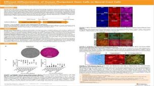 Efficient Generation of Human Pluripotent Stem Cells to Neural Crest Cells