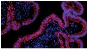 Mouse Intestinal Organoid Course