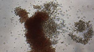 Human Hematopoietic CFU Assay Course