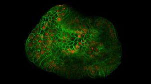 Hepatic Organoid Course