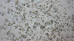 Mouse Hematopoietic CFU Assay Course