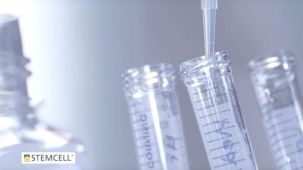 How to Culture Mouse Intestinal Organoids: Passaging