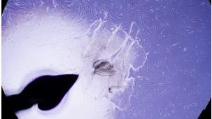 How to Reprogram Fibroblasts into Human Induced Pluripotent Stem (iPS) Cells Using ReproRNA™-OKSGM