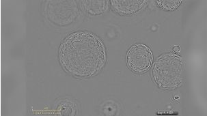 Growth of Liver Organoids in HepatiCult™ Culture Medium: Under a Microscope