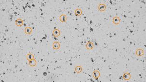How to Count Intestinal Crypts for Mouse Organoid Cultures