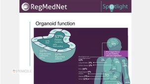 Spotlight on Organoids: Expert Panel
