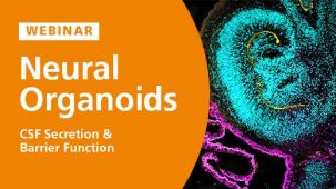 Modeling Brain Barrier Permeability and CSF Secretion with Choroid Plexus Organoids