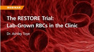 The RESTORE Trial: Lab-Grown RBCs in the Clinic