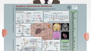 SnapShot: Glioblastoma Multiforme