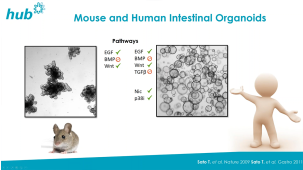 Patient-Derived Organoids for Drug Screening and Development
