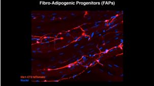The Secret In Vivo Life of "Mesenchymal Stem Cells"