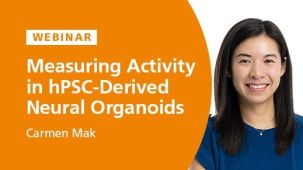 Measuring Activity in hPSC-Derived Neural Organoids