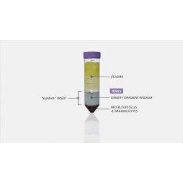 How to Isolate PBMCs from Whole Blood Using the SepMate™ PBMC Isolation ...