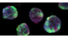 How to Generate hPSC-Derived 3D Kidney Organoids Using STEMdiff™