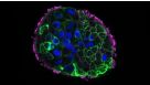 How to Generate Apical-Out Nasal Organoids