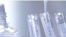 How to Culture Mouse Intestinal Organoids: Passaging