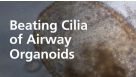 Beating Cilia of Airway Organoids Grown in PneumaCult™