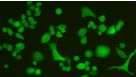 ALDEFLUOR™ and Cancer Stem Cells