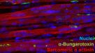 3D Modeling of Skeletal Muscle for In Vitro Functional Assaying