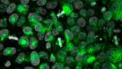 CRISPR-Cas9 Gene Editing of Cerebral Organoids to Model Microcephaly